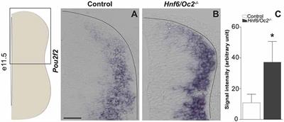 Pou2f2 Regulates the Distribution of Dorsal Interneurons in the Mouse Developing Spinal Cord